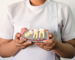 How Are Wisdom Teeth Removed?